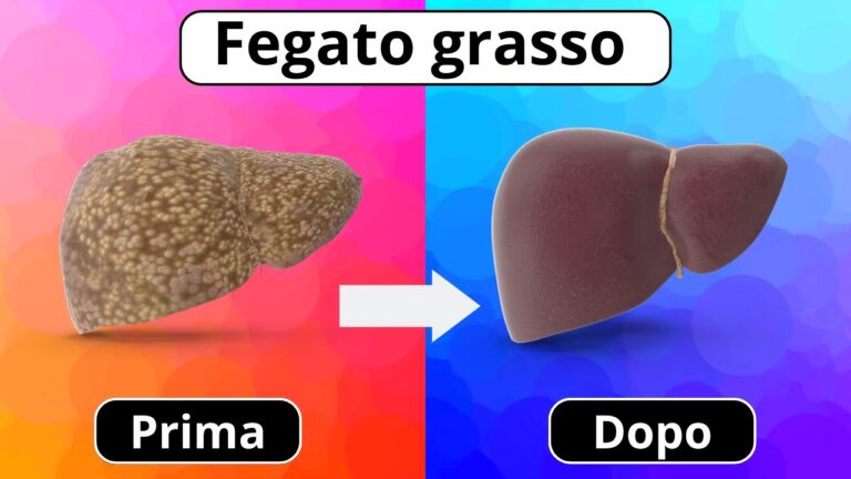 Calorie e Salute del Fegato: Guida Essenziale
